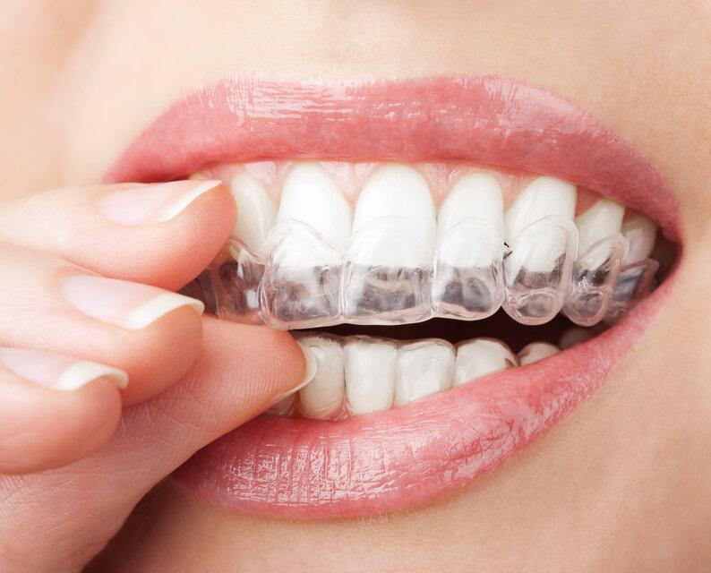 close up of woman using invisalign in germantown