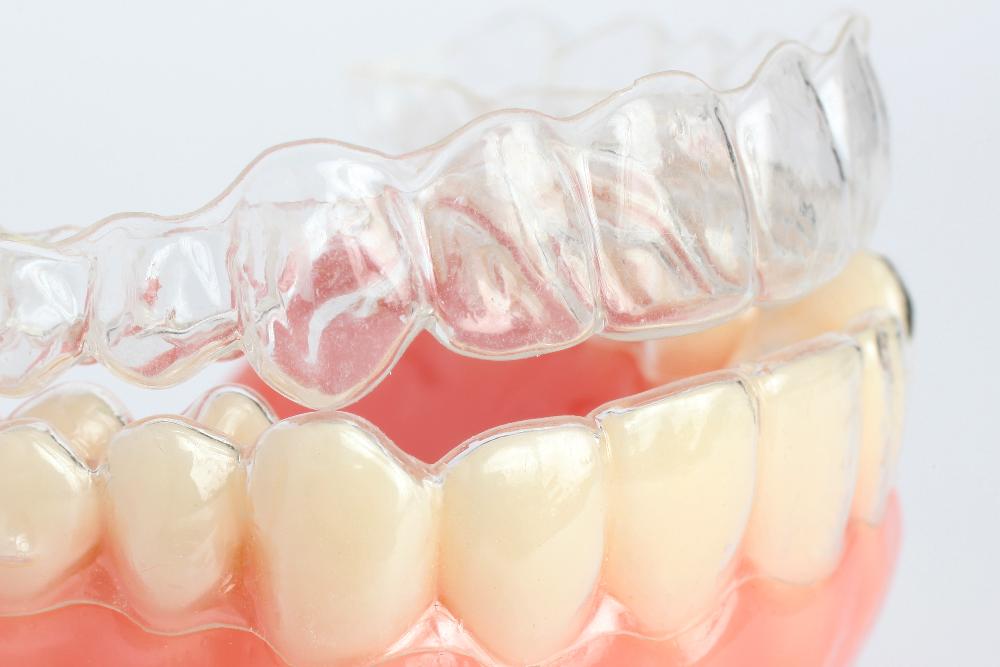 clear aligners in germantown